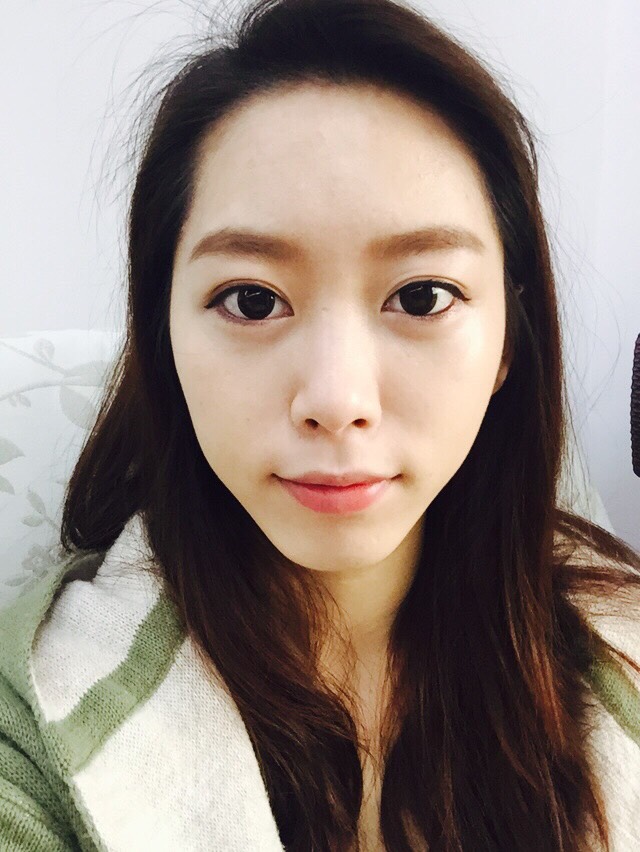 洢蓮絲, Ellanse, 依戀詩 - 豐頰, 蘋果肌 洢蓮絲, Ellanse, 依戀詩 - 豐頰, 蘋果肌