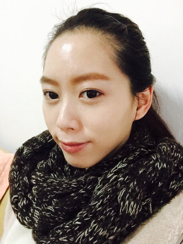 少女針,洢蓮絲, Ellanse, 依戀詩 - 豐額, 夫妻宮 少女針,洢蓮絲, Ellanse, 依戀詩 - 豐額, 夫妻宮