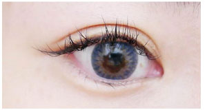 隱形雙眼皮貼 => 半開放式雙眼皮(外雙) 隱形雙眼皮貼 => 半開放式雙眼皮(外雙)