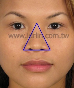 東方人鼻型 東方人鼻形