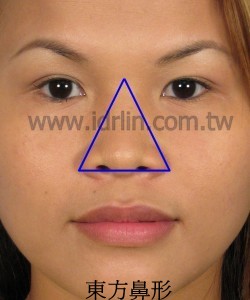 東方鼻型 東方鼻形