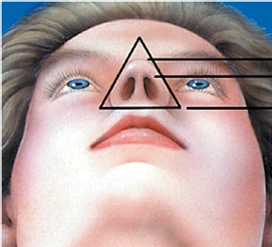 由下往上看呈正三角形為佳 由下往上看呈正三角形為佳