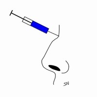 玻尿酸隆鼻 玻尿酸隆鼻