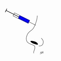 玻尿酸隆鼻 玻尿酸隆鼻