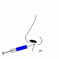 玻尿酸隆鼻 玻尿酸隆鼻