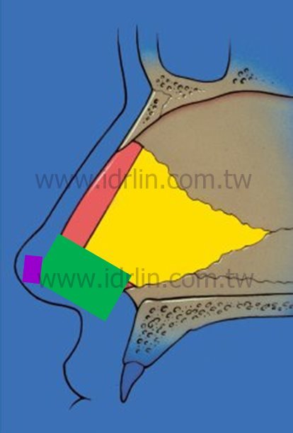 適合台灣人的韓式隆鼻 – ESG韓式隆鼻 適合台灣人的韓式隆鼻 – ESG韓式隆鼻