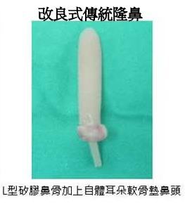 改良式傳統隆鼻 改良式傳統隆鼻