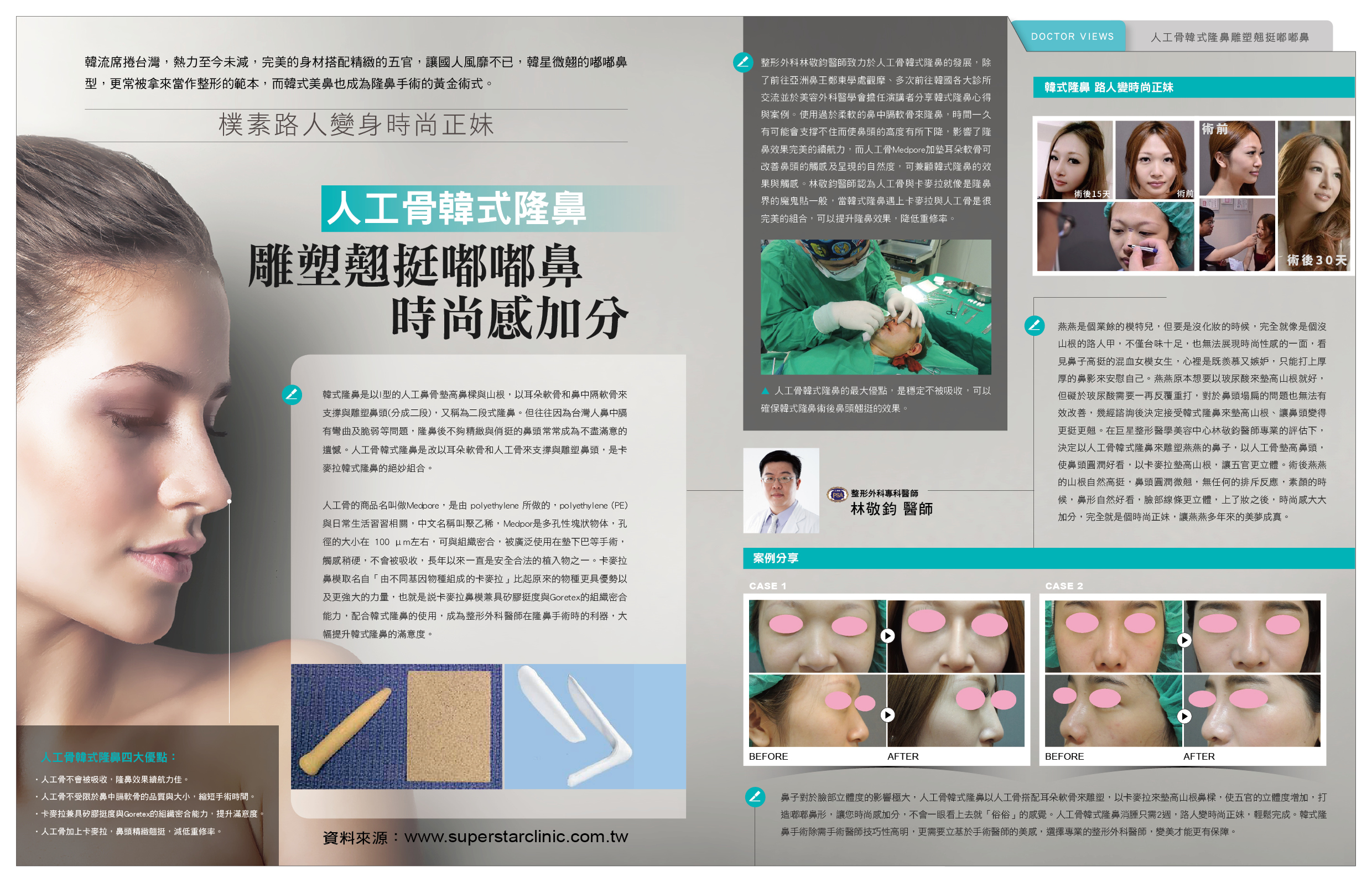 韓式隆鼻 韓式隆鼻