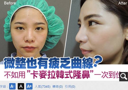 微整也有疲乏曲線?不如用"卡麥拉韓式隆鼻"一次到位! 微整也有疲乏曲線?不如用"卡麥拉韓式隆鼻"一次到位!