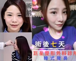 韓式隆鼻更經濟實惠!杯具,停不下來的微整不歸路 韓式隆鼻更經濟實惠!杯具,停不下來的微整不歸路