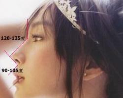 隆鼻標準化其中最重要的莫過於額鼻角和唇鼻角 隆鼻標準化其中最重要的莫過於額鼻角和唇鼻角