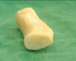 人工肋骨 異體肋軟骨