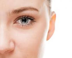 雙眼皮手術 雙眼皮手術