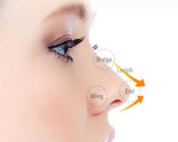 人工肋骨韓式隆鼻 異體肋骨韓式隆鼻