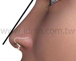 微翹的鼻頭會略高於鼻樑約2mm, 是好看精緻的鼻頭 微翹的鼻頭會略高於鼻樑約2mm, 是好看精緻的鼻頭