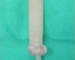 山寨版兩段式隆鼻