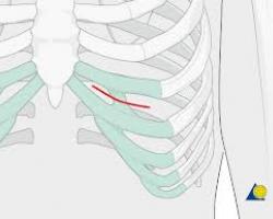 全自體肋骨隆鼻 全自體肋骨隆鼻
